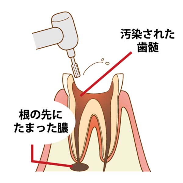 口腔内状況の検査